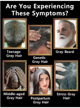 How This Simple Serum Stopped My Early White Hair Without Harsh Dyes!
